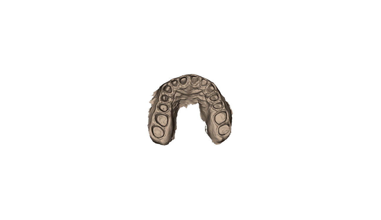 
        digital scan of mouth